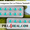 Imágenes De La Píldora Tadalafil 29